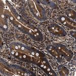 ABCG8 Antibody in Immunohistochemistry (Paraffin) (IHC (P))