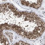 UPF1 Antibody in Immunohistochemistry (Paraffin) (IHC (P))