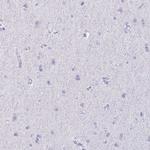 DAZL Antibody in Immunohistochemistry (Paraffin) (IHC (P))