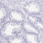 DAZL Antibody in Immunohistochemistry (Paraffin) (IHC (P))