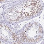 DAZL Antibody in Immunohistochemistry (Paraffin) (IHC (P))