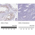 DAZL Antibody in Immunohistochemistry (IHC)