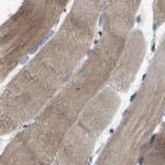 MYO18A Antibody in Immunohistochemistry (IHC)