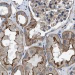 MYO18A Antibody in Immunohistochemistry (IHC)