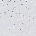 KRT76 Antibody in Immunohistochemistry (Paraffin) (IHC (P))