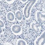 KRT76 Antibody in Immunohistochemistry (Paraffin) (IHC (P))