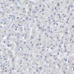 KRT76 Antibody in Immunohistochemistry (Paraffin) (IHC (P))