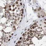 TPR Antibody in Immunohistochemistry (IHC)