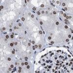 TPR Antibody in Immunohistochemistry (IHC)