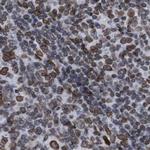 TPR Antibody in Immunohistochemistry (IHC)