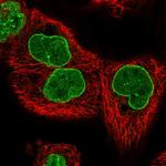 TPR Antibody in Immunocytochemistry (ICC/IF)