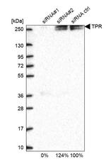 TPR Antibody in Western Blot (WB)