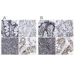 TPR Antibody in Immunohistochemistry (IHC)