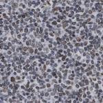 TPR Antibody in Immunohistochemistry (IHC)