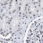 TPR Antibody in Immunohistochemistry (IHC)