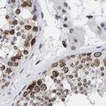 TPR Antibody in Immunohistochemistry (IHC)