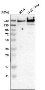 TPR Antibody in Western Blot (WB)