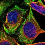 NOV Antibody in Immunocytochemistry (ICC/IF)