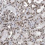 PSIP1 Antibody in Immunohistochemistry (Paraffin) (IHC (P))