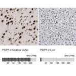 PSIP1 Antibody in Immunohistochemistry (IHC)