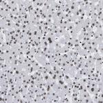 PSIP1 Antibody in Immunohistochemistry (IHC)