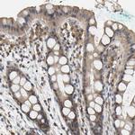 Myotrophin Antibody in Immunohistochemistry (Paraffin) (IHC (P))