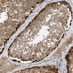 Myotrophin Antibody in Immunohistochemistry (Paraffin) (IHC (P))