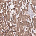 MYL2 Antibody in Immunohistochemistry (Paraffin) (IHC (P))