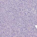 MYL2 Antibody in Immunohistochemistry (Paraffin) (IHC (P))