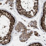 C7orf20 Antibody in Immunohistochemistry (IHC)