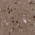 C7orf20 Antibody in Immunohistochemistry (IHC)