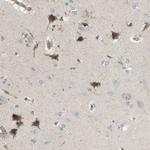 AKAP13 Antibody in Immunohistochemistry (IHC)