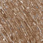 AKAP13 Antibody in Immunohistochemistry (IHC)