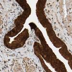 AKAP13 Antibody in Immunohistochemistry (IHC)