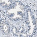 DAZL Antibody in Immunohistochemistry (Paraffin) (IHC (P))