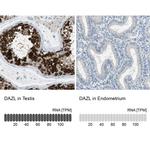 DAZL Antibody in Immunohistochemistry (IHC)