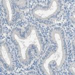 DAZL Antibody in Immunohistochemistry (IHC)