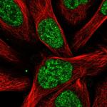 RBM15 Antibody in Immunocytochemistry (ICC/IF)