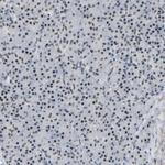 RBM15 Antibody in Immunohistochemistry (Paraffin) (IHC (P))