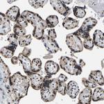 RBM15 Antibody in Immunohistochemistry (Paraffin) (IHC (P))