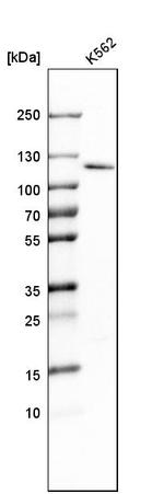 RBM15 Antibody in Western Blot (WB)