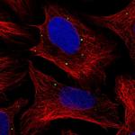 NUDT5 Antibody in Immunocytochemistry (ICC/IF)