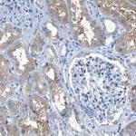 NUDT5 Antibody in Immunohistochemistry (Paraffin) (IHC (P))