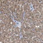 NUDT5 Antibody in Immunohistochemistry (Paraffin) (IHC (P))