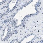 NUDT5 Antibody in Immunohistochemistry (Paraffin) (IHC (P))