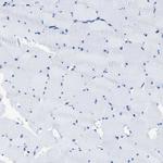 NUDT5 Antibody in Immunohistochemistry (Paraffin) (IHC (P))