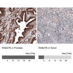 RAB27B Antibody in Immunohistochemistry (IHC)