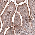 RAB27B Antibody in Immunohistochemistry (IHC)