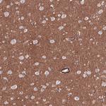 RAB27B Antibody in Immunohistochemistry (IHC)