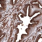 RAB27B Antibody in Immunohistochemistry (IHC)